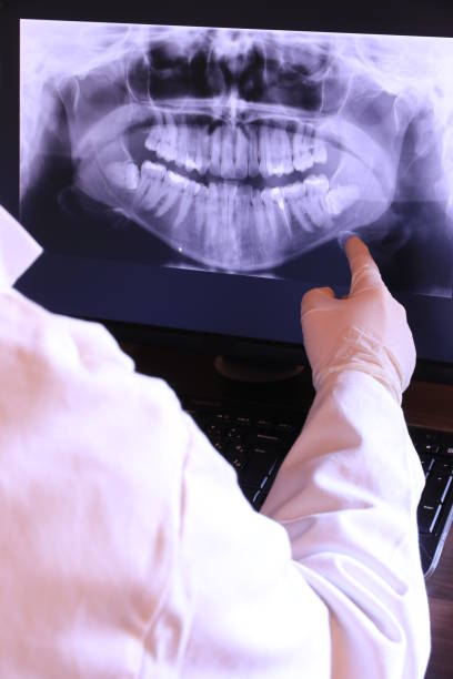 Best Emergency Tooth Extraction in Monfort Heights, OH