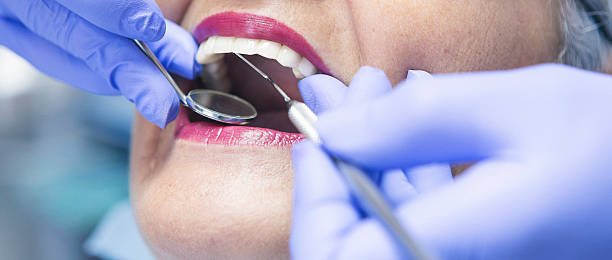 Best Emergency Root Canal Treatment in Monfort Heights, OH